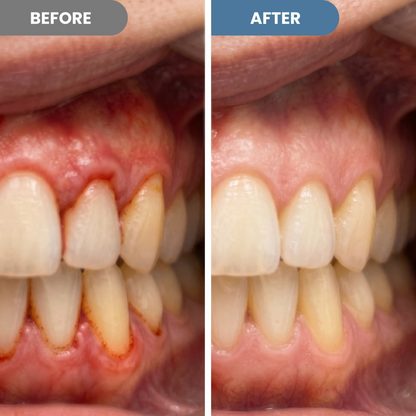 📢📢UP to 68% Off!!⏰ KAEVOX Teeth Whitening & Repair Gel 🦷