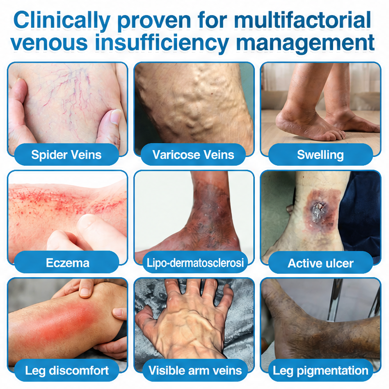 Brinliva · Pathophysiology of CVI