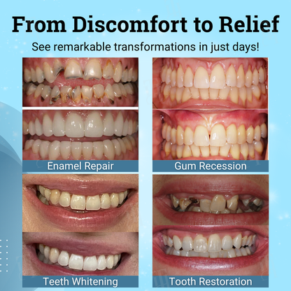 📢📢UP to 68% Off!!⏰ Teeth Whitening & Repair Gel 🦷