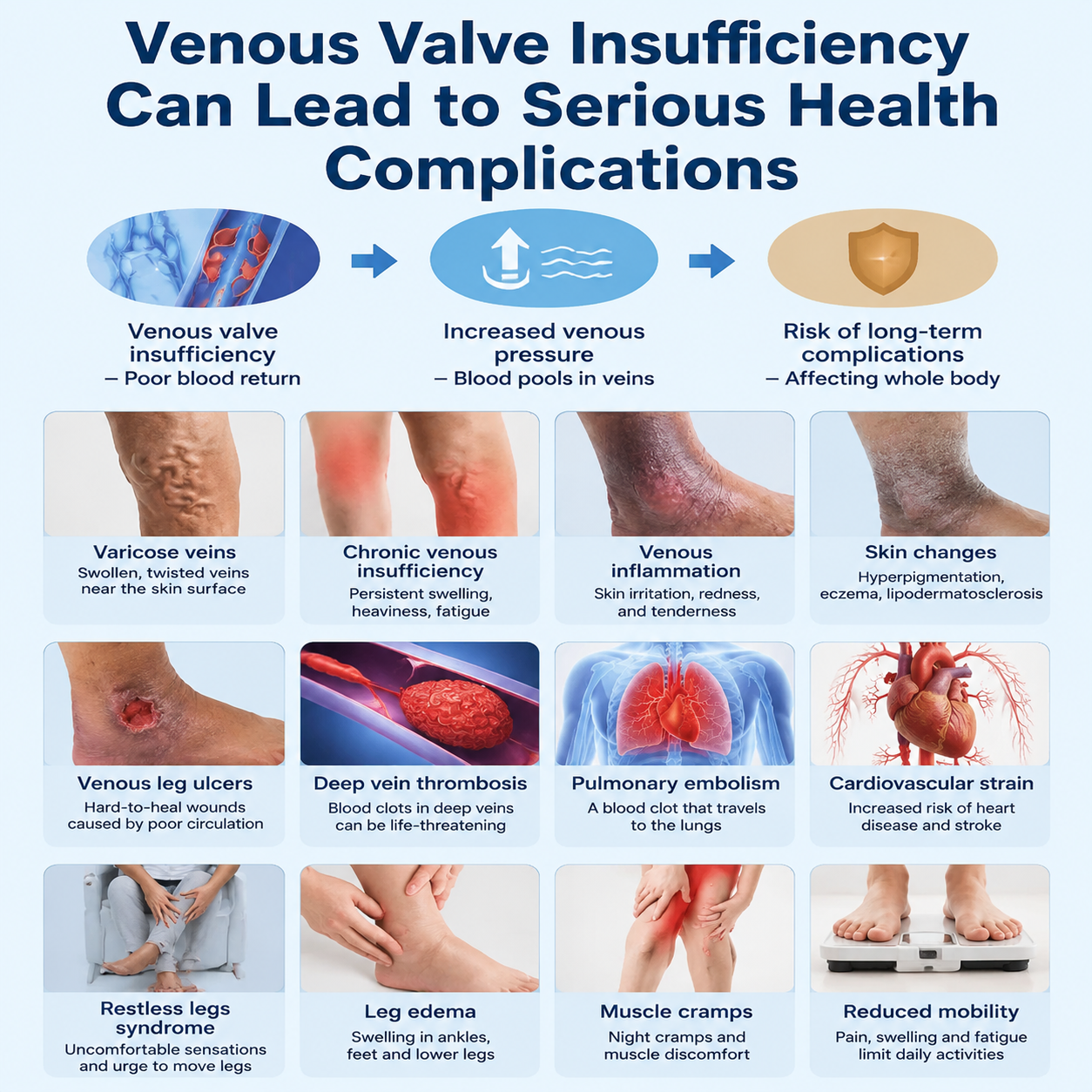 Venous valve illustration · blue tone